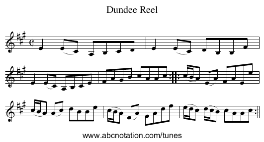 Dundee Reel - staff notation