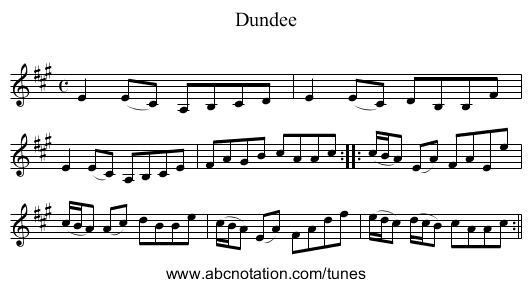 Dundee - staff notation
