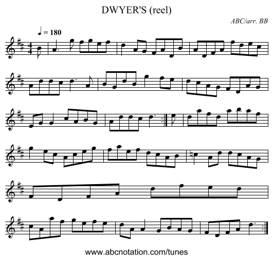 DWYER'S (reel) - staff notation
