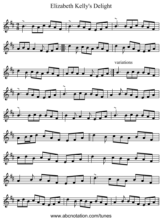 Elizabeth Kelly's Delight - staff notation