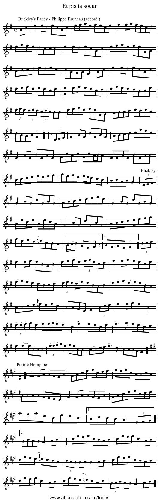 Et pis ta soeur - staff notation