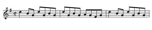 Foxhunter's Reel, The - staff notation