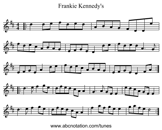Frankie Kennedy's - staff notation