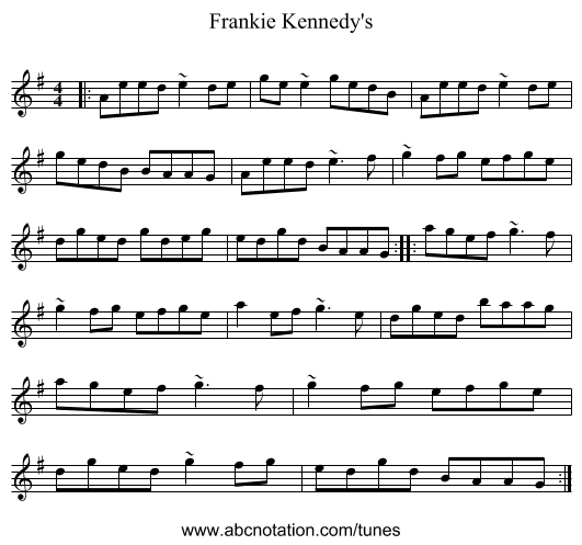 Frankie Kennedy's - staff notation