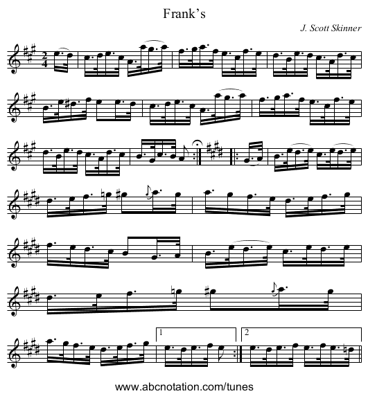 Frank’s - staff notation