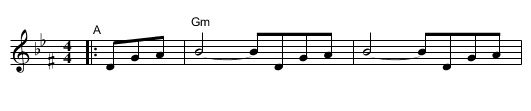 Freilach: The Silver Wedding #2 [Gm] - staff notation