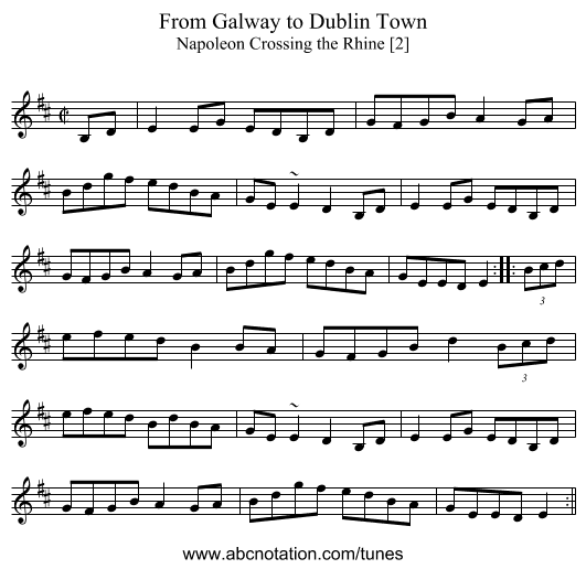 From Galway to Dublin Town - staff notation