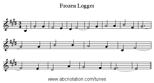 Frozen Logger - staff notation