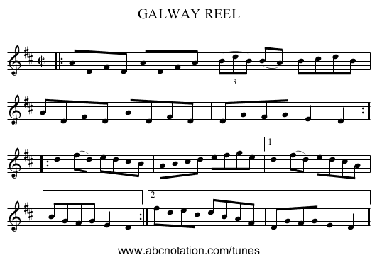 GALWAY REEL - staff notation