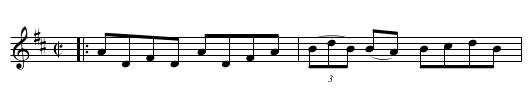 GALWAY REEL - staff notation