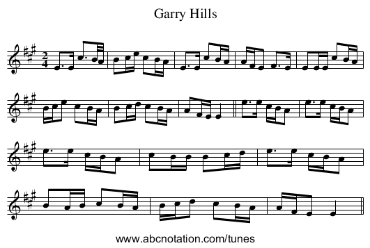 Garry Hills - staff notation