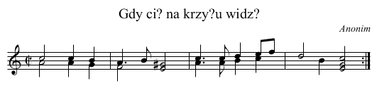 Gdy ci? na krzy?u widz? - staff notation