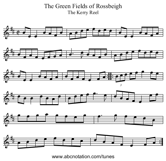 Green Fields of Rossbeigh, The - staff notation