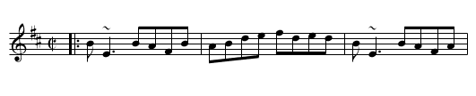 Green Fields of Rossbeigh - staff notation