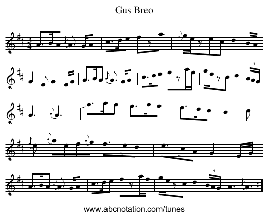 Gus Breo - staff notation
