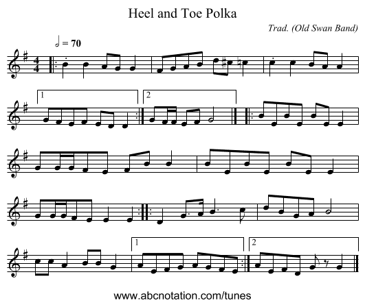 Heel and Toe Polka - staff notation