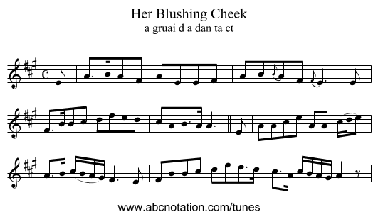 Her Blushing Cheek - staff notation