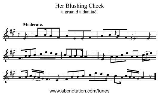 Her Blushing Cheek - staff notation