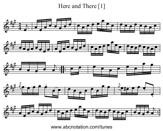 Here and There [1] - staff notation