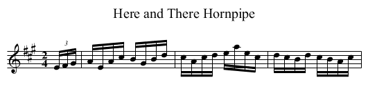 Here and There Hornpipe - staff notation