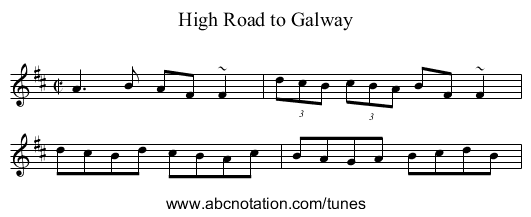 High Road to Galway - staff notation
