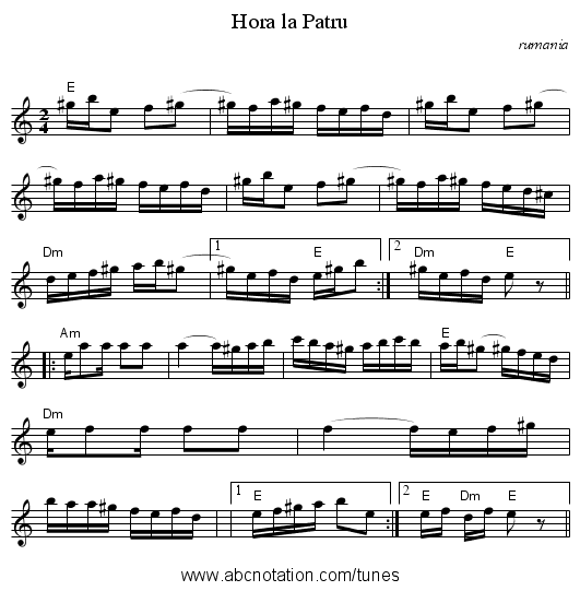 Hora la Patru - staff notation