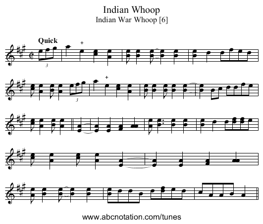 Indian Whoop - staff notation