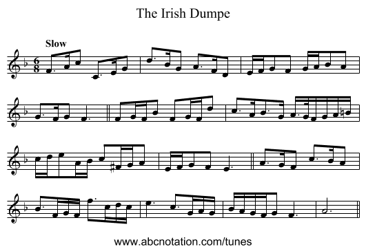 Irish Dumpe, The - staff notation