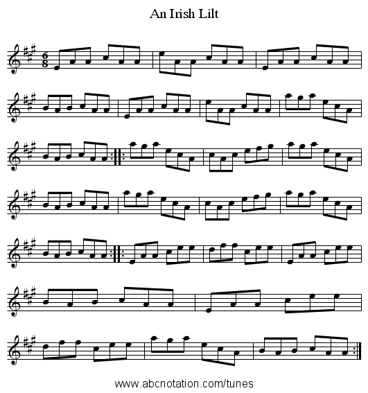 Irish Lilt, An - staff notation