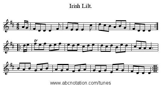Irish Lilt. - staff notation