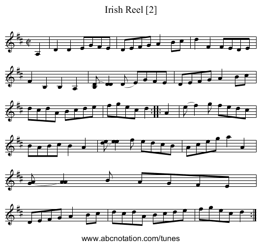 Irish Reel [2] - staff notation