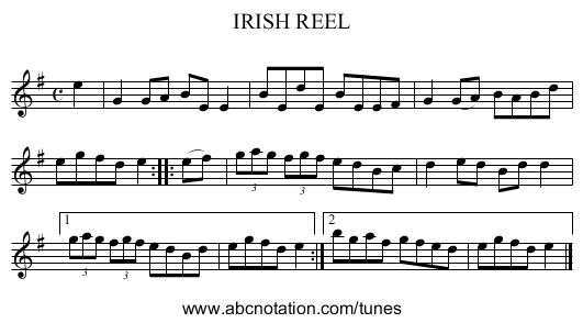 IRISH REEL - staff notation