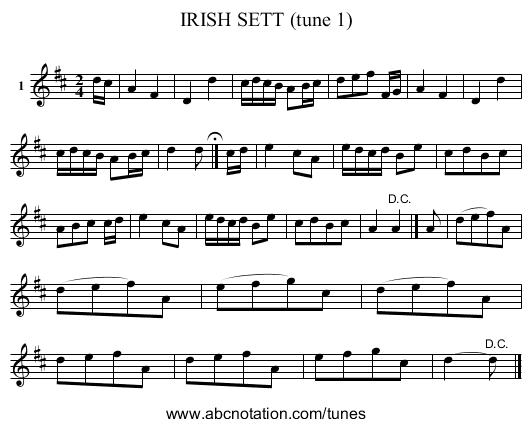 IRISH SETT (tune 1) - staff notation