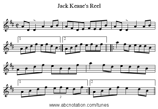 Jack Keane's Reel - staff notation