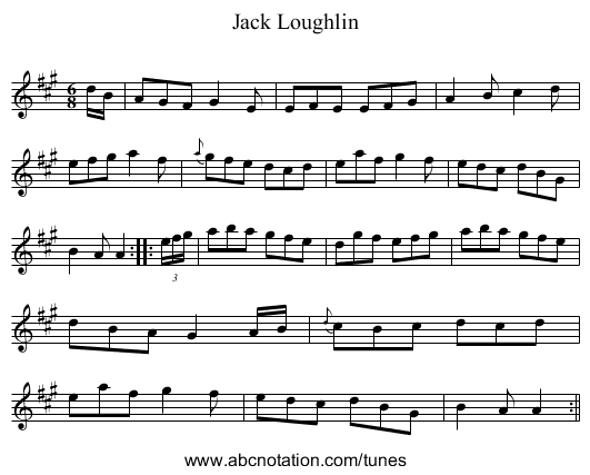 Jack Loughlin - staff notation