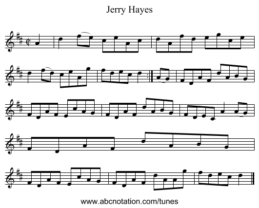 Jerry Hayes - staff notation