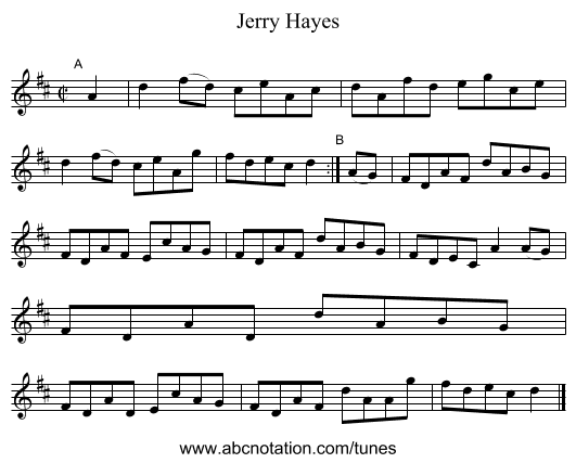 Jerry Hayes - staff notation