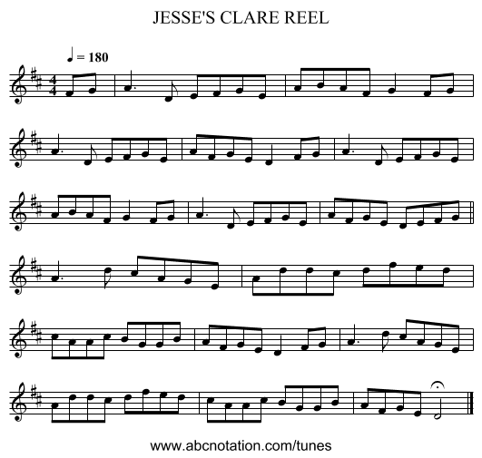 JESSE'S CLARE REEL - staff notation