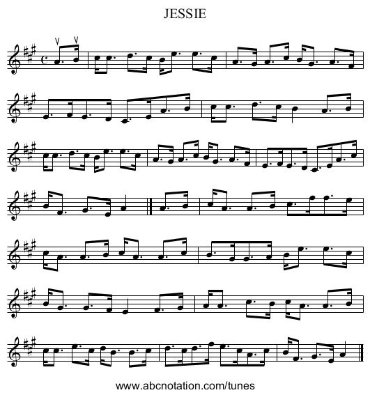 JESSIE - staff notation