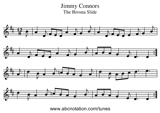 Jimmy Connors - staff notation