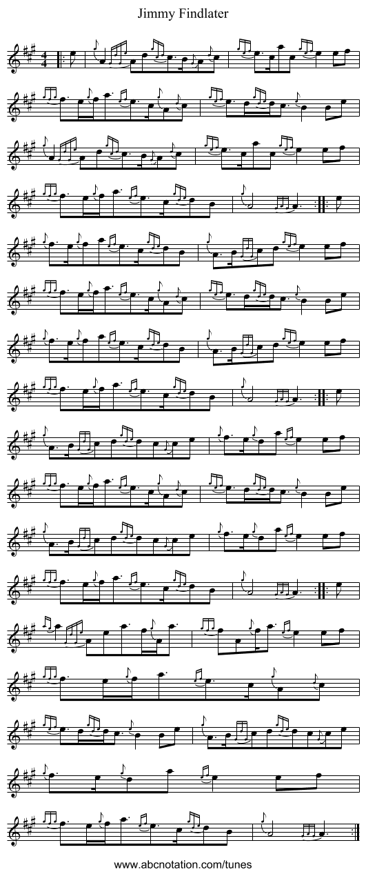 Jimmy Findlater - staff notation