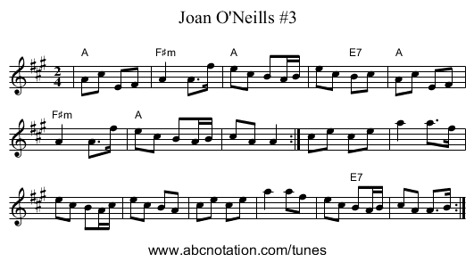 Joan O'Neills #3 - staff notation