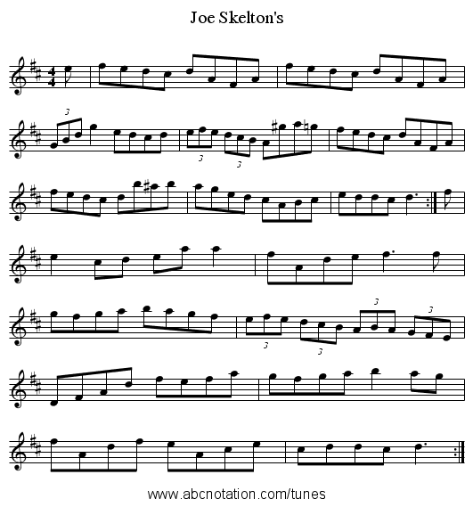 Joe Skelton's - staff notation