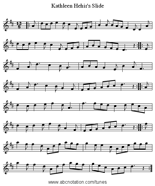 Kathleen Hehir's Slide - staff notation