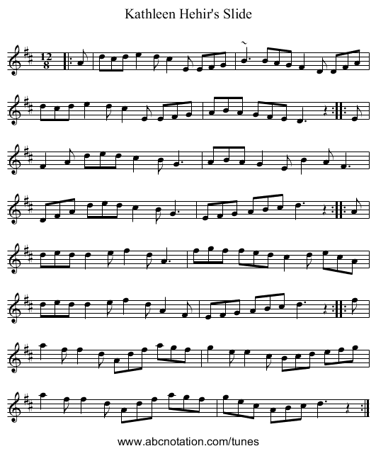 Kathleen Hehir's Slide - staff notation