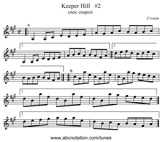 Keeper Hill   #2 - staff notation