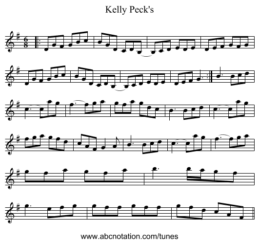 Kelly Peck's - staff notation