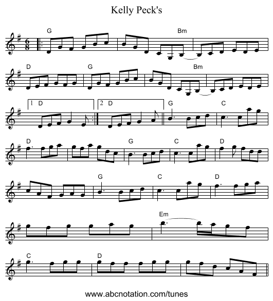 Kelly Peck's - staff notation