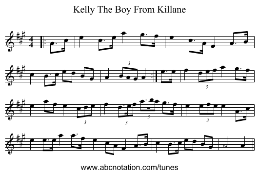 Kelly The Boy From Killane - staff notation