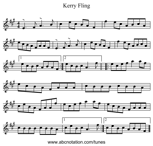 Kerry Fling - staff notation